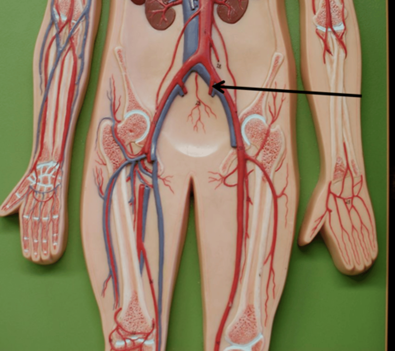 <p>Name the blood vessel.</p>