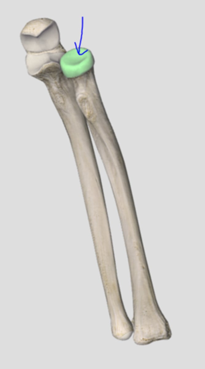 <p>Cup on top of radius</p>