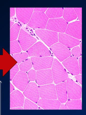 \-the most common picture is called H& E srain of cross section of muscle, which involves specific staining chemicals applied to tissue section

\-hemotoxilin penetrates the nucleus, and when it does, it gives this purple colour 

\-eisin penetrates the membrane, and gives this pink colour that marks where cytoplasm it 

\-so when looking at cross section, we can see the membrane and nuclei (and some satellite cells)

* cant see cellular contents, so cant determine type of muscle fibre

\-after adding the chemicals, we use microscope to examine it 