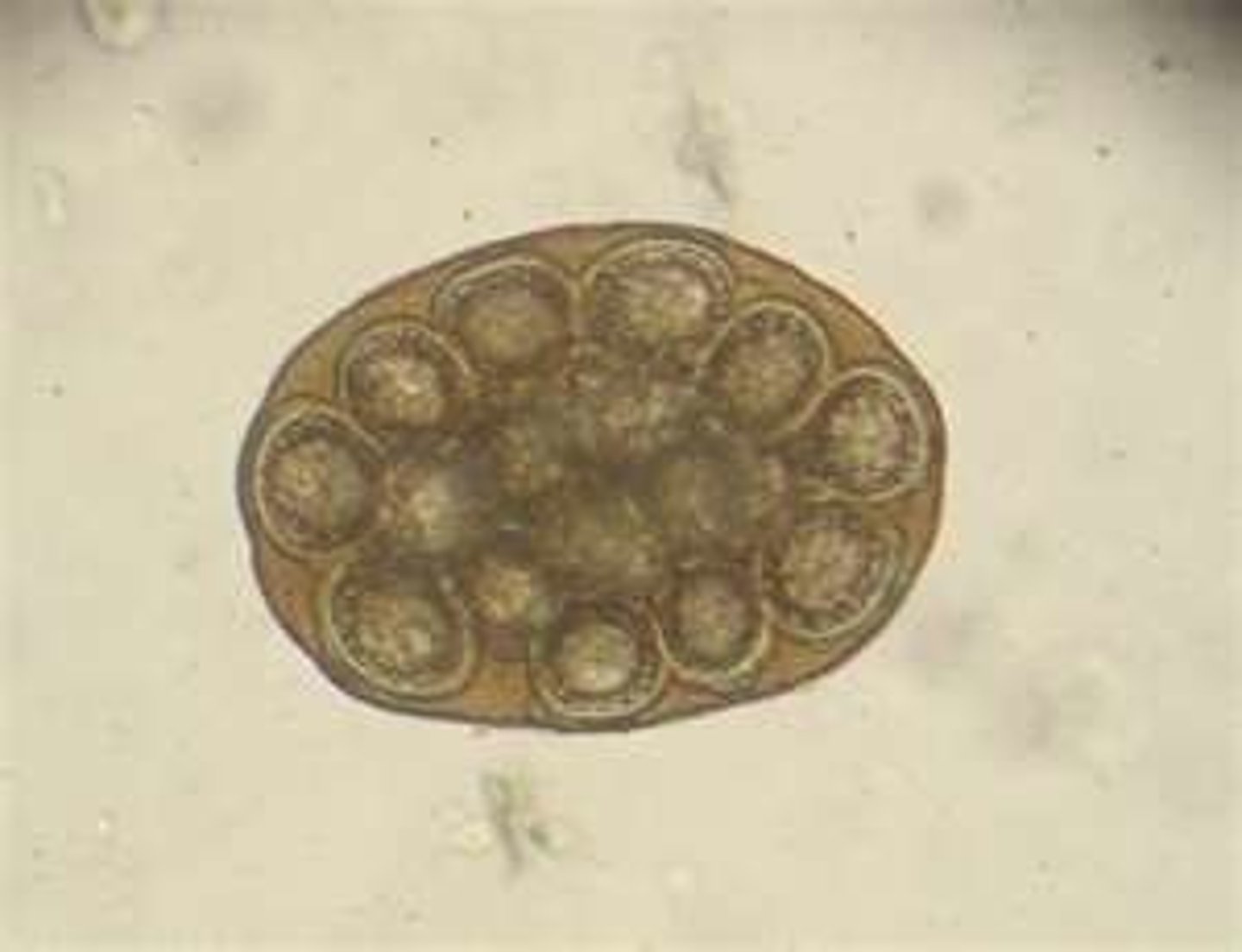 <p>What parasite is this if it is from a cat</p>