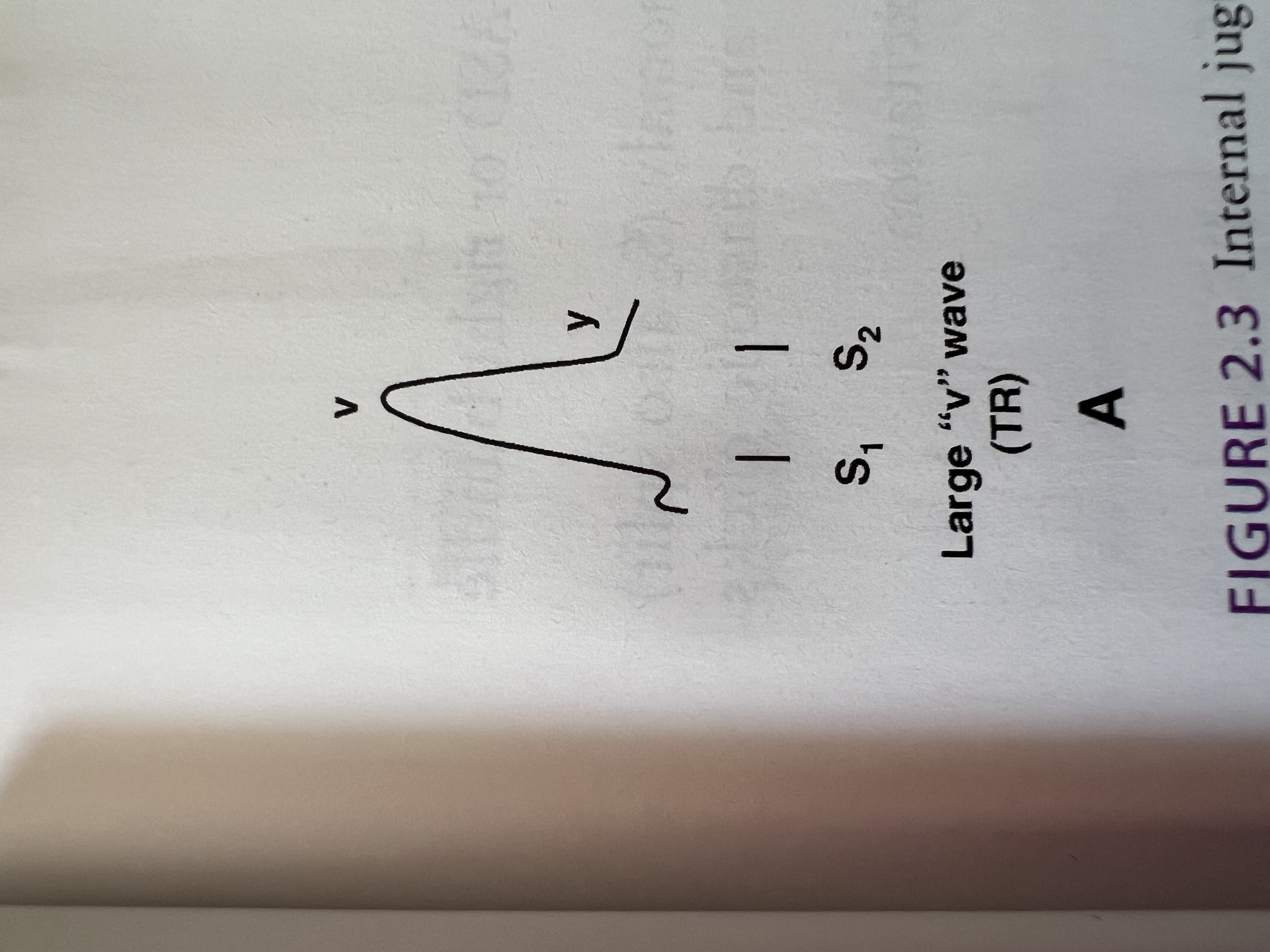 <p>Large 'v' wave with a rapid 'y' descent.</p>