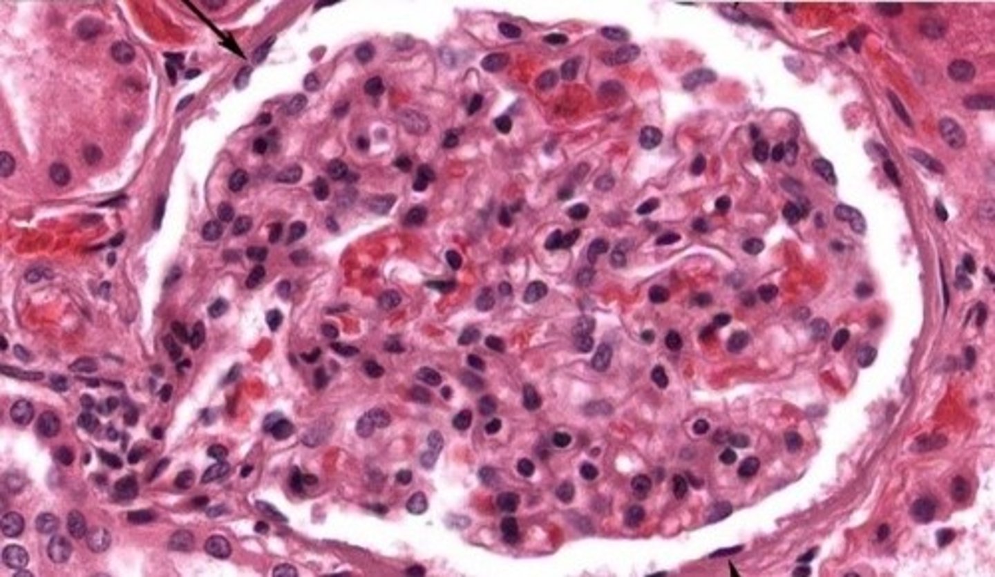 <p>outer and inner layer of the browman's capsule of renal corpuscles on kidney</p>