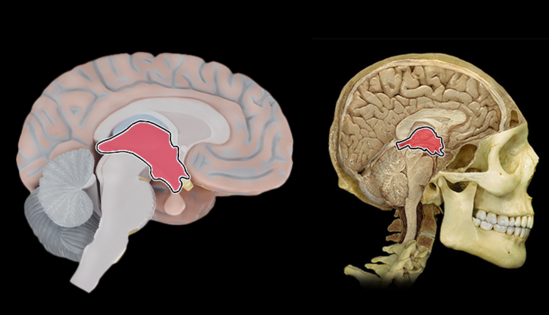 term image