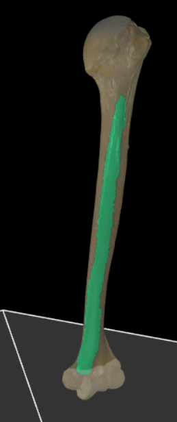 <p>De voorste mediale zijde van de humerus.</p>