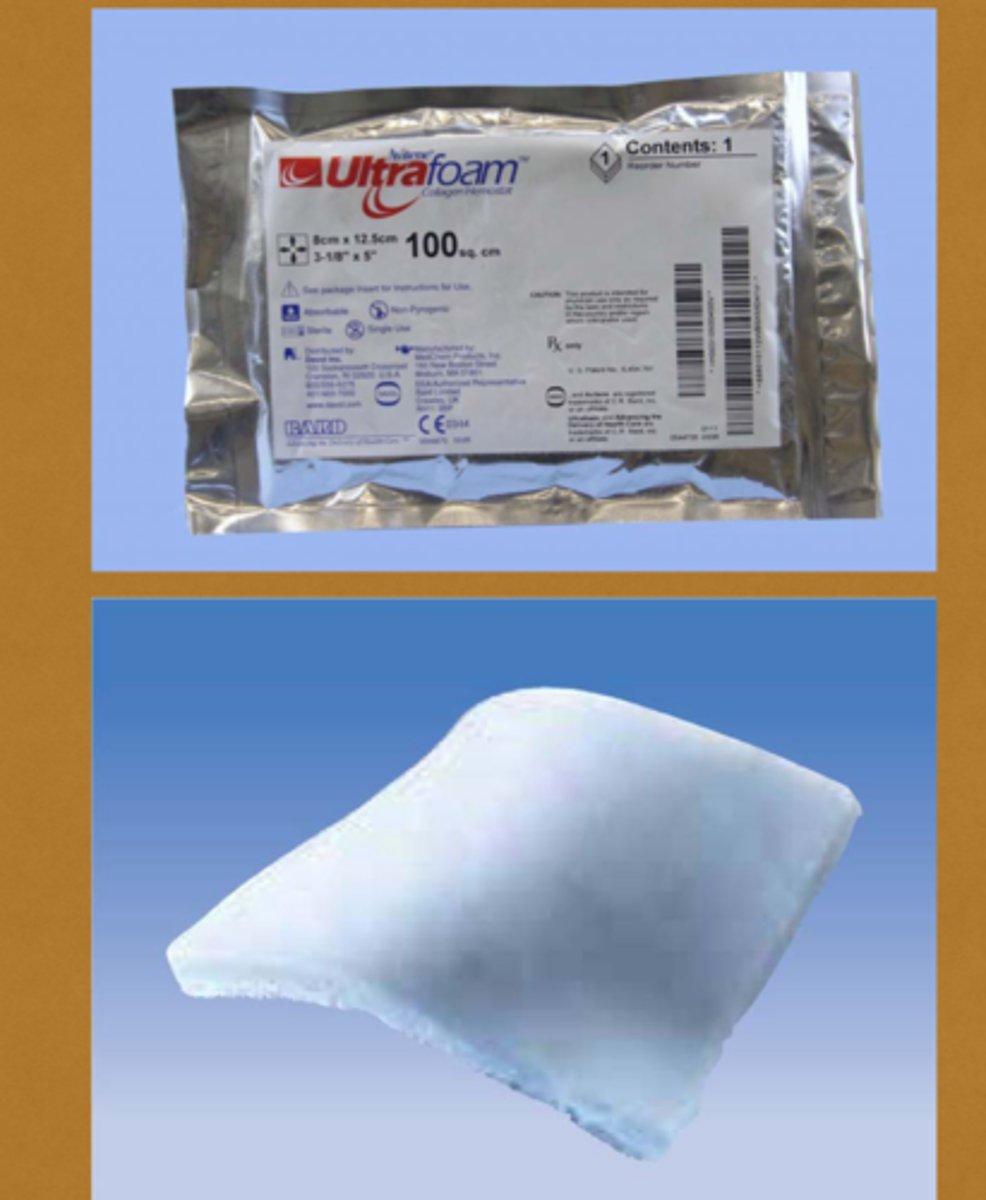 <p>Ultrafoam collagen sponges enhance platelet aggregation and the release of proteins which accelerate clot formation. They are made of soft and absorbable collagen and are used to maintain hemostasis.</p>
