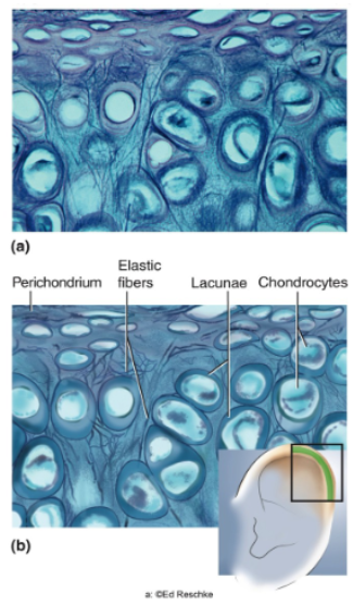 <p>Elastic fibers form weblike mesh amid lacunae, always covered by perichondrium.</p>