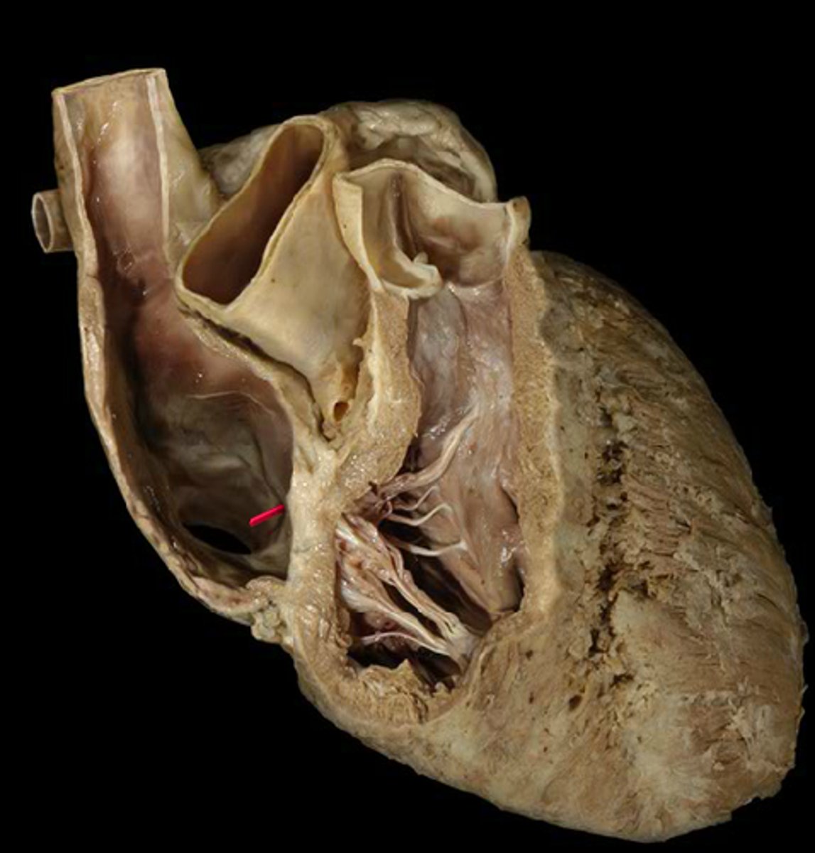 <p>returns venous coronary circulation to right atrium</p>