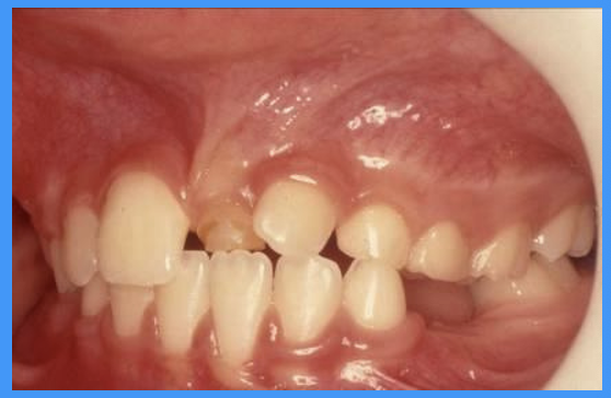 <p>what does this clinical image show</p>