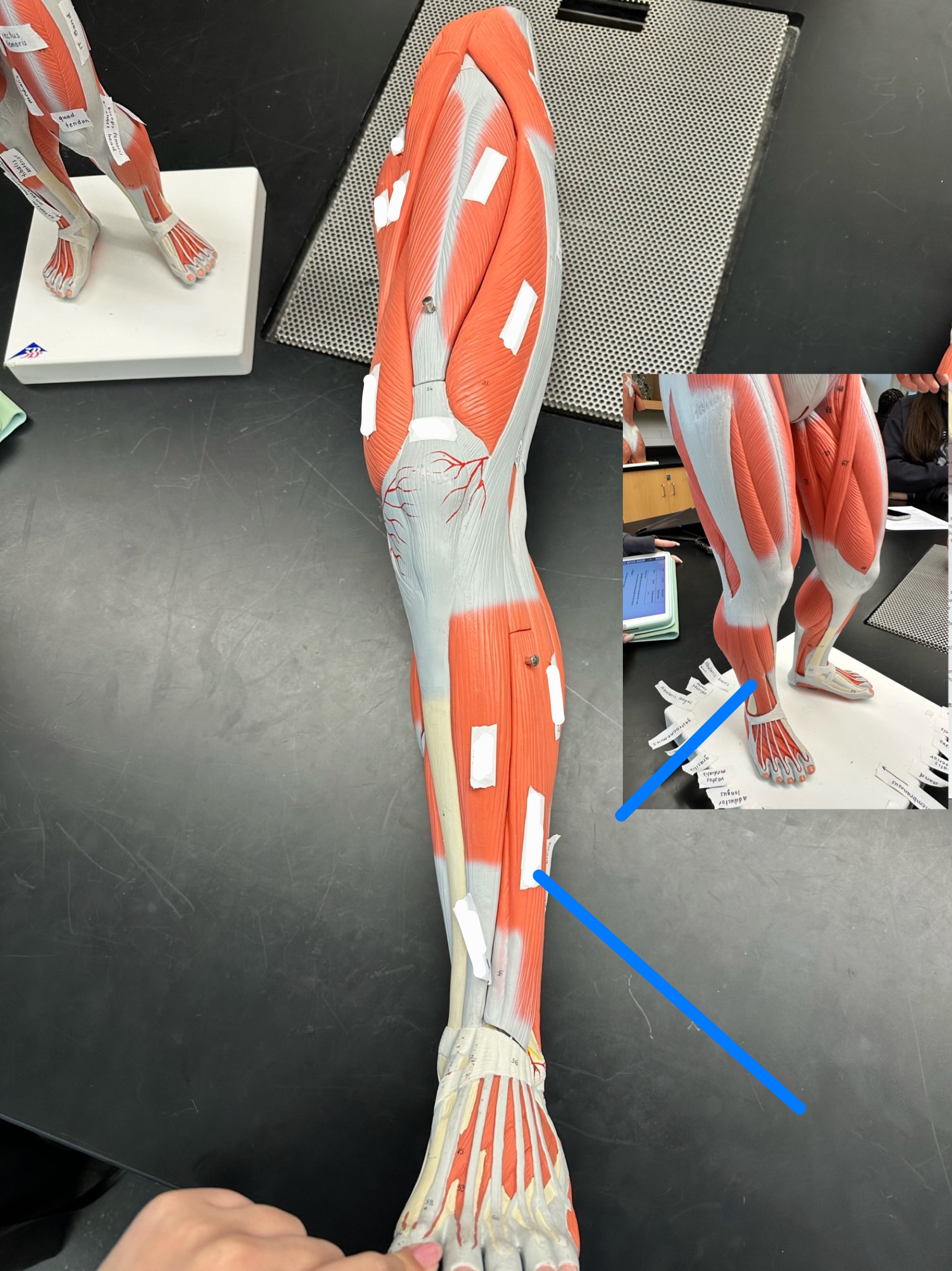 <p>ID muscle</p>