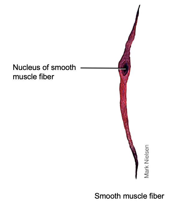 <p>Visceral (smooth muscle)</p>