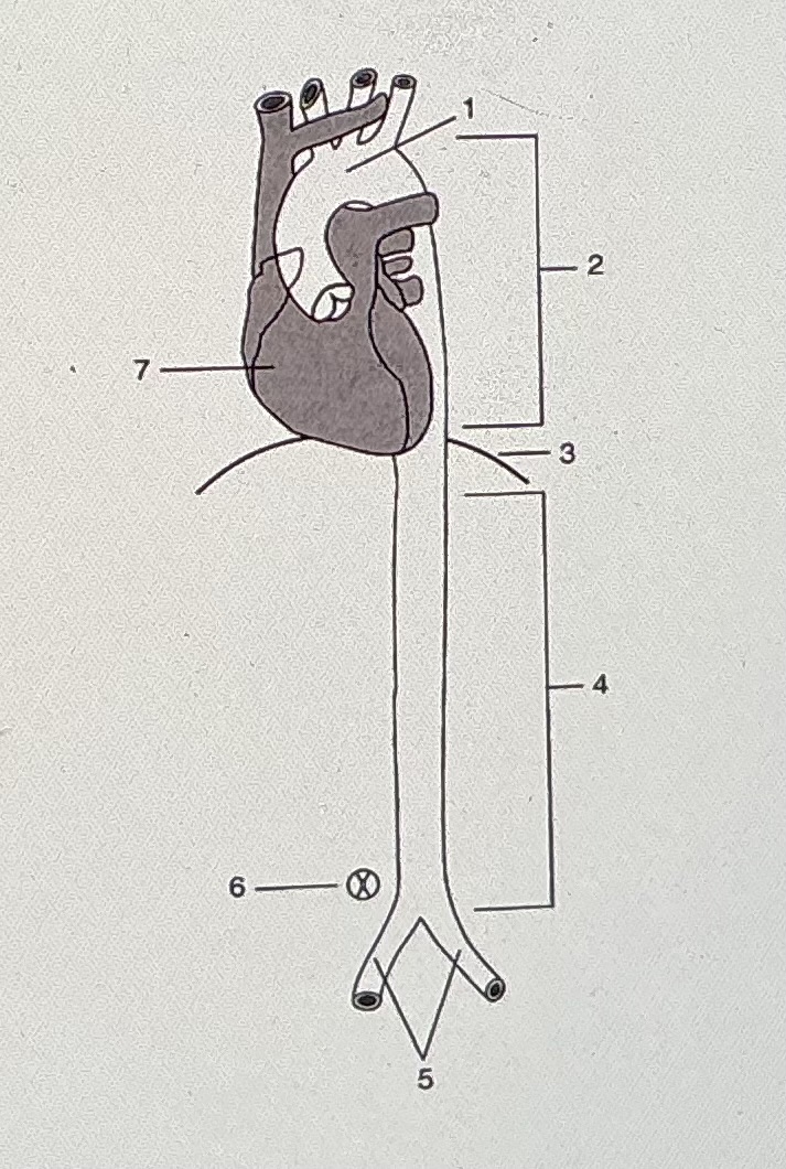 <p>#3 refers to the rectus abdominus muscle</p>