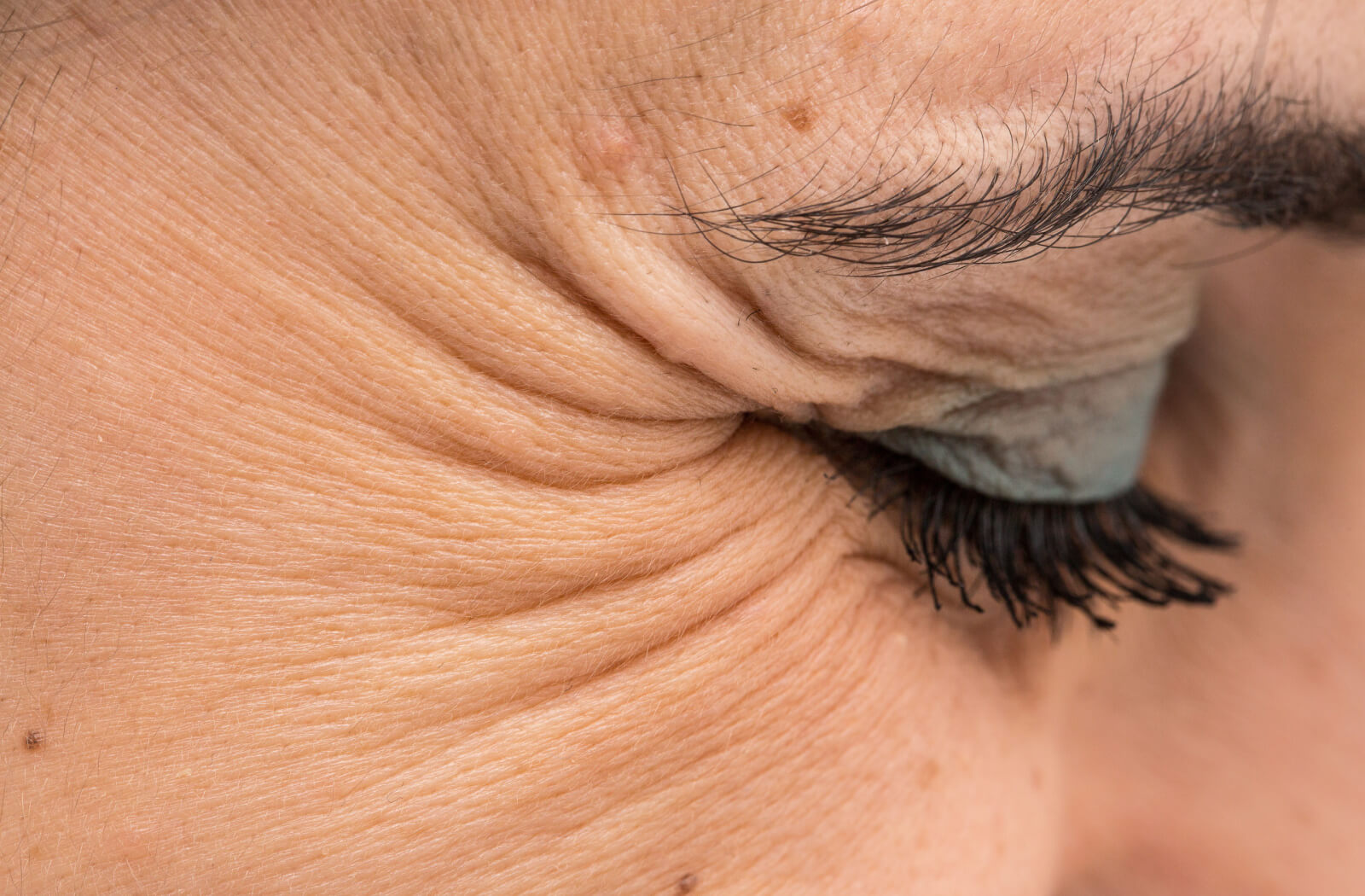 <p>Optic facial sulci</p>