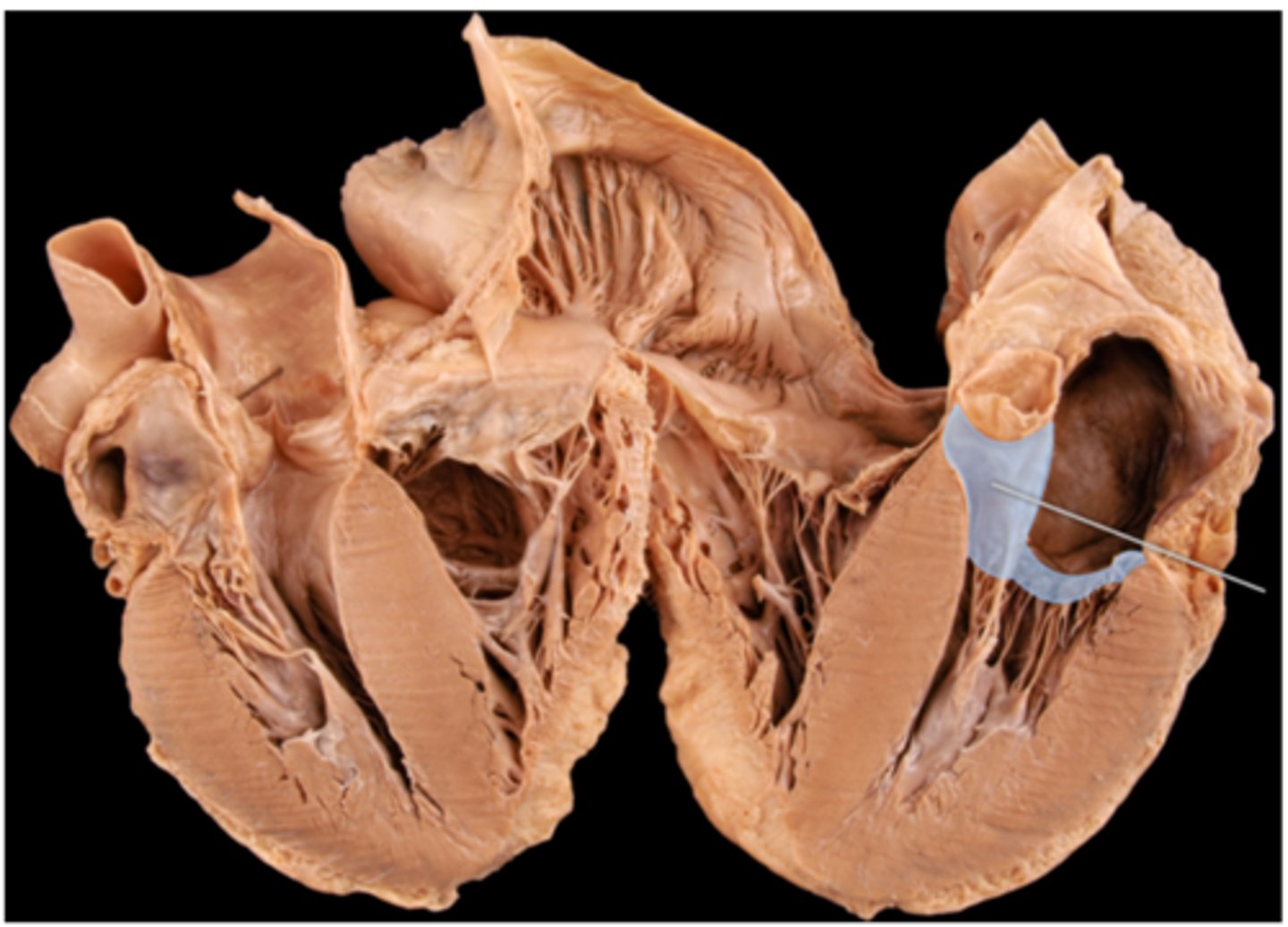 <p>ventricular systole</p>