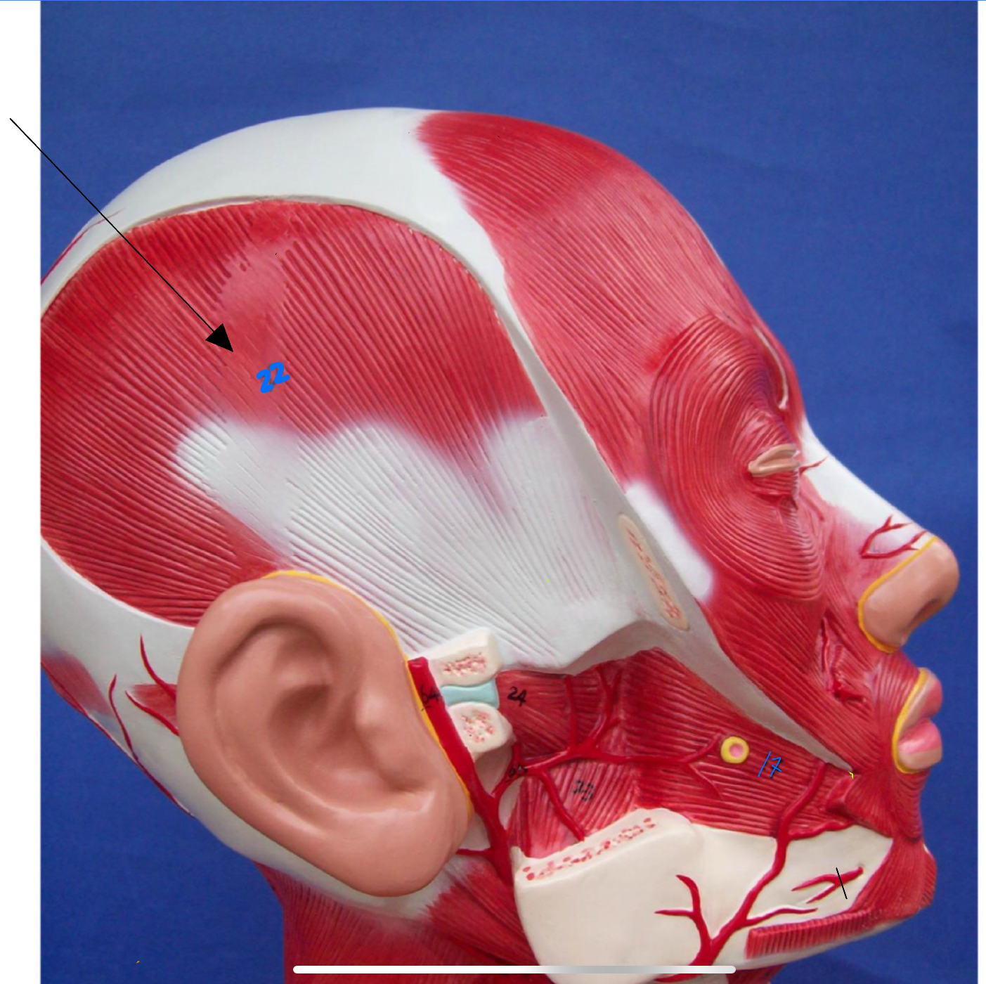 <p>What type of muscle is this ( altay model )</p>