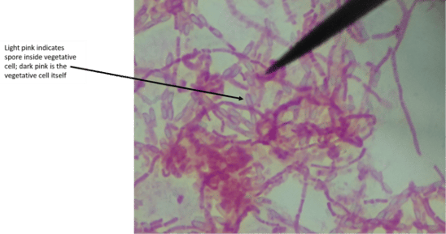 <p>what type of stain is this?</p>