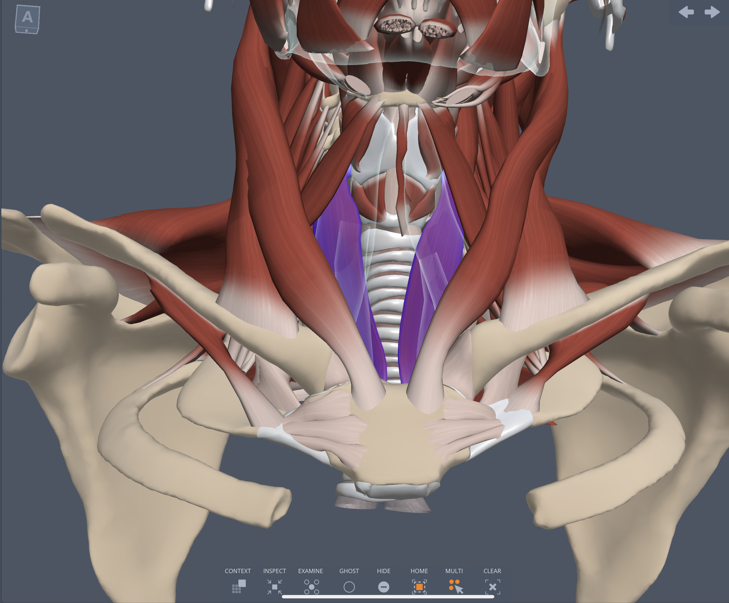 Origin of the Sternothyroid muscle 