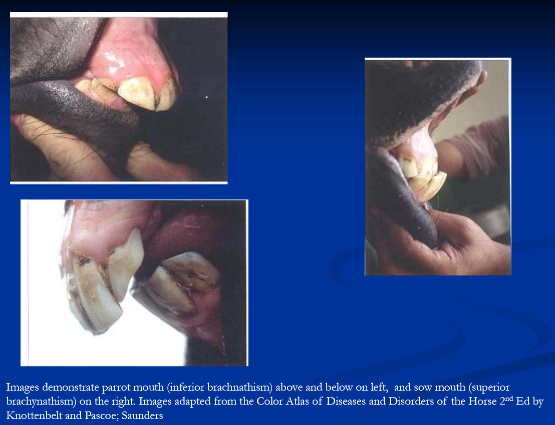 <p>developmental anomalies of teeth </p>