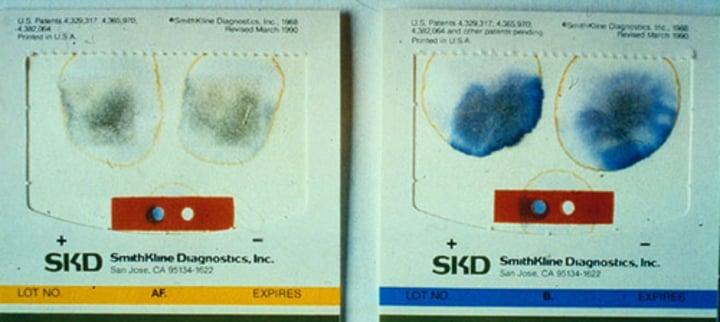 <p>Check stool for the presence of blood. <br>+Blood=Blue</p>