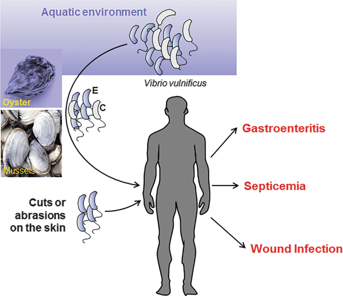 <p>A <strong>bacteria found in</strong> <strong>warm seawater. </strong>It can cause severe foodborne illness <strong>from eating raw seafood </strong>(like oysters) and life-threatening infections if it enters wounds, sometimes leading to sepsis or necrotizing fasciitis.</p>