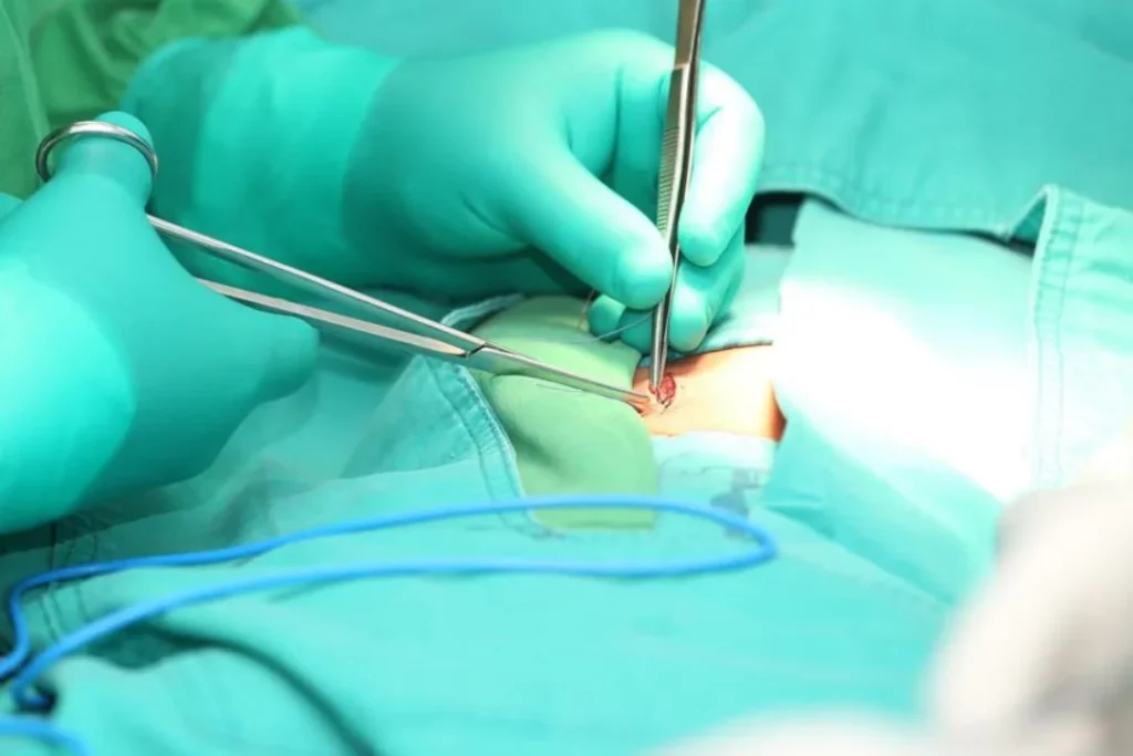 <p>ostomy (suffix)</p>