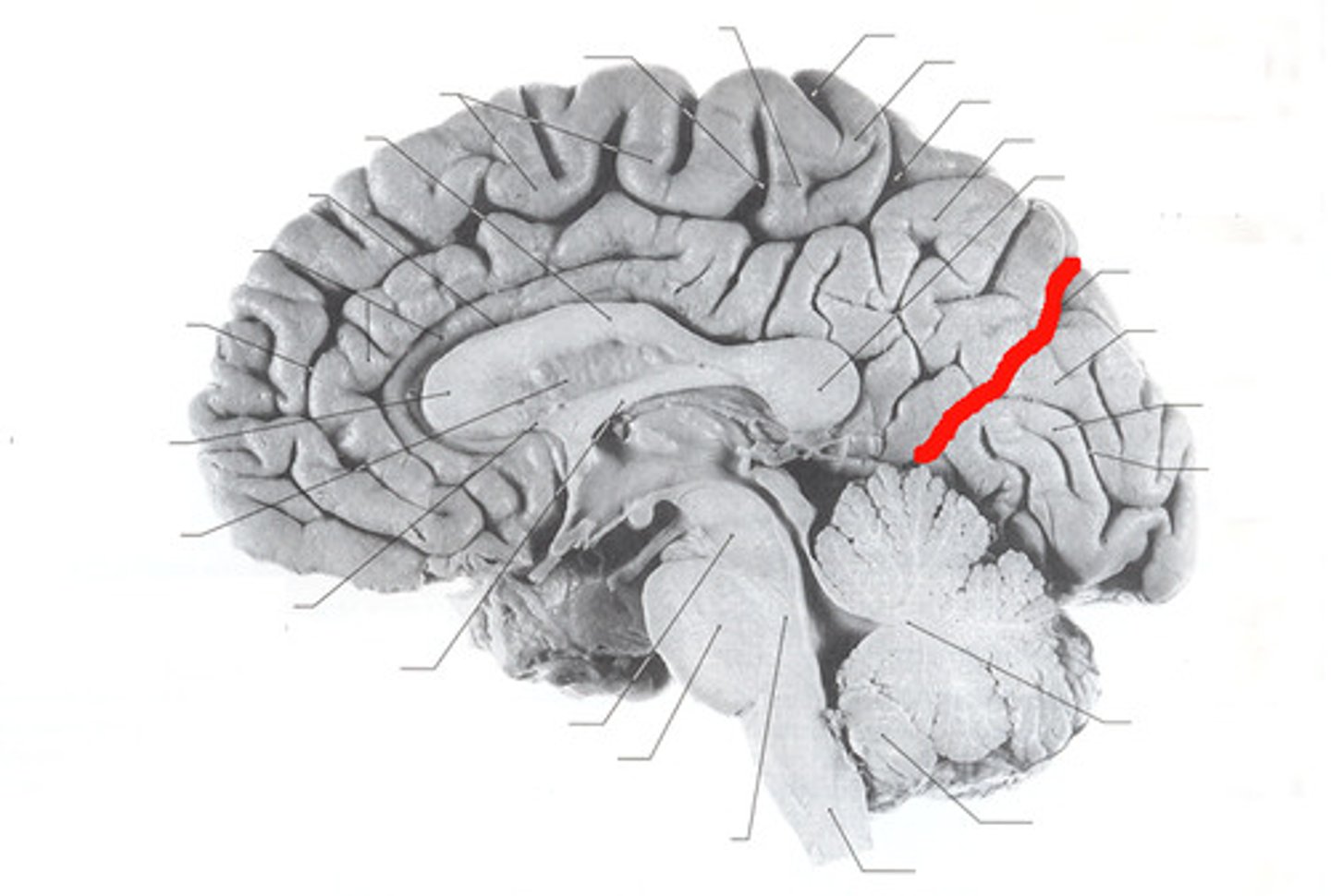 <p>separates parietal and occipital lobes</p>