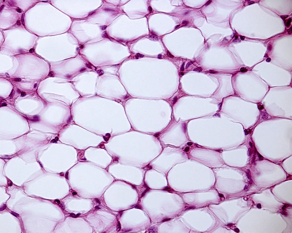 <p><strong>Picture example of adipose tissue:</strong></p>