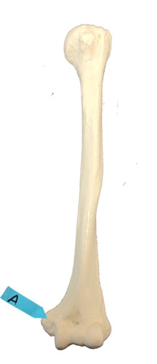 <p>Identify this bone marking.</p>