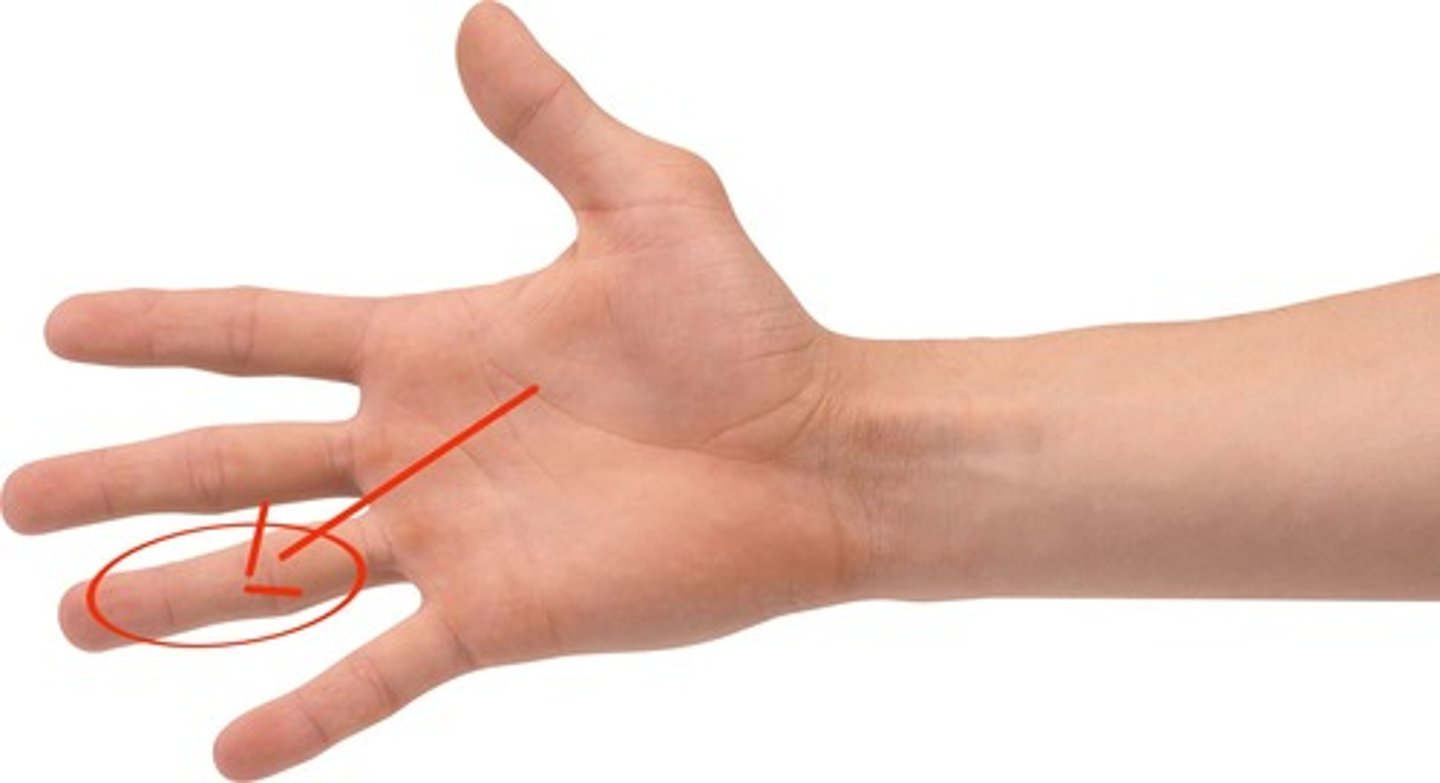 <p>ring finger</p>