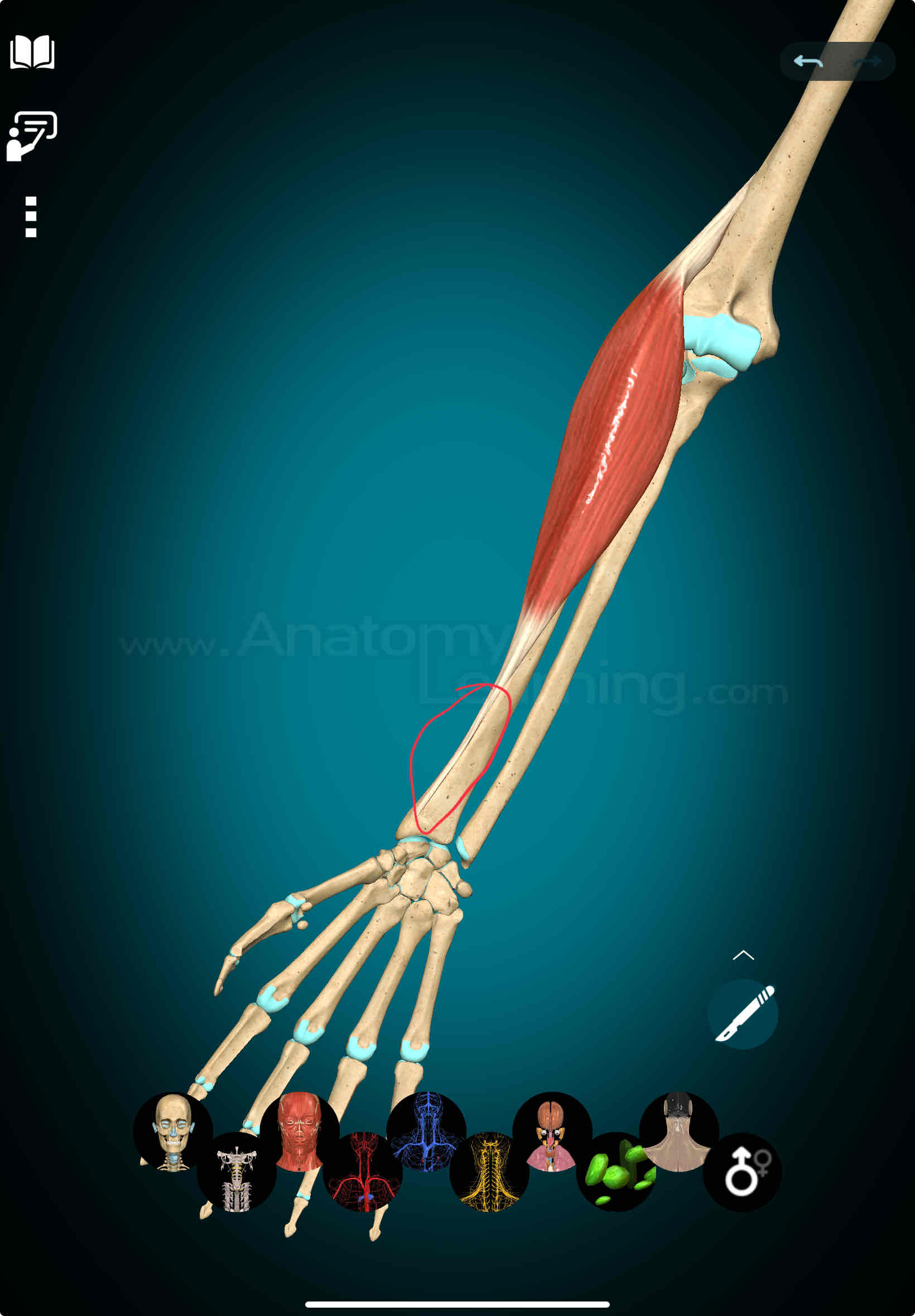 <p>Brachioradialis Insertion</p>