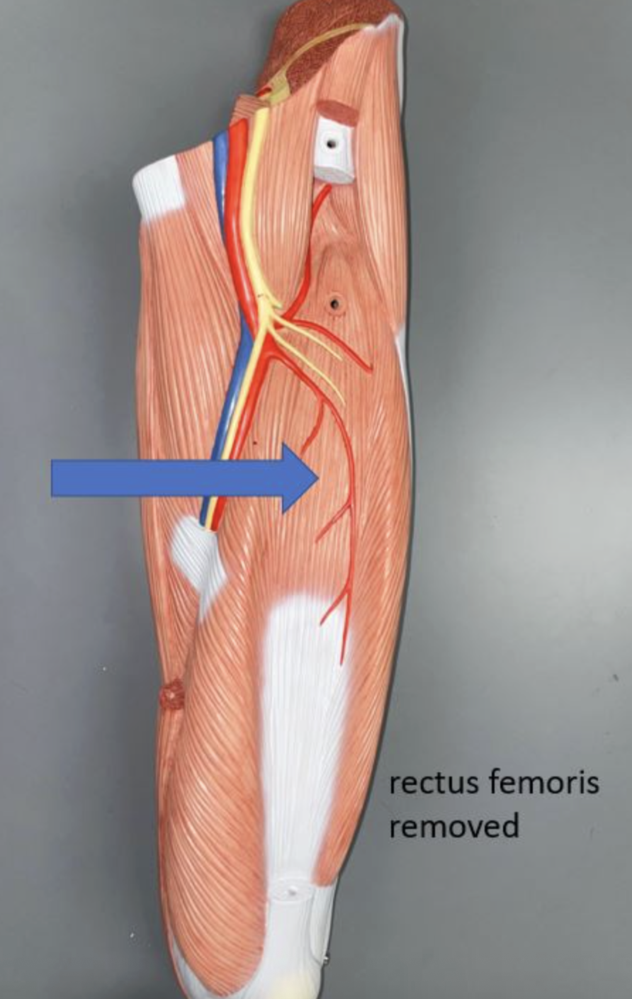 <p>muscle name &amp; action</p>