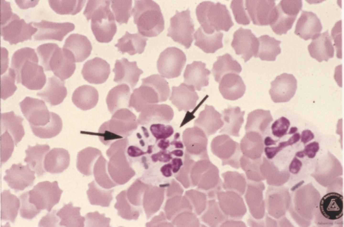 <p>Identify the cells in this body fluid</p>