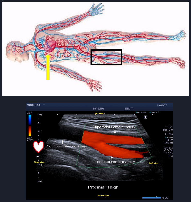 <p>describe the blood flow occurring in this image</p>