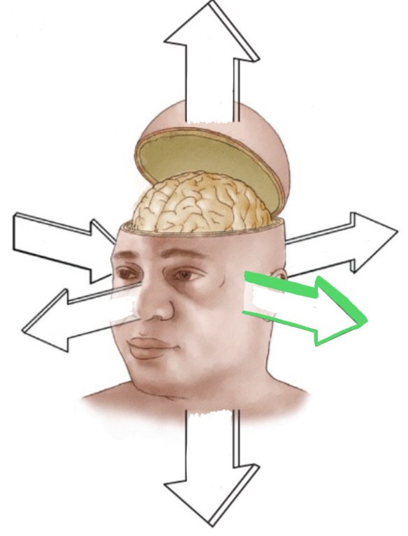 <p>At the side of the face, away from the midline.</p>