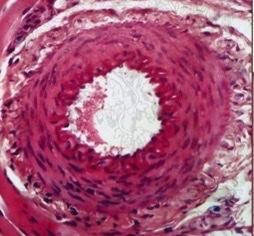 <p>What artery type? What features identify it?</p>