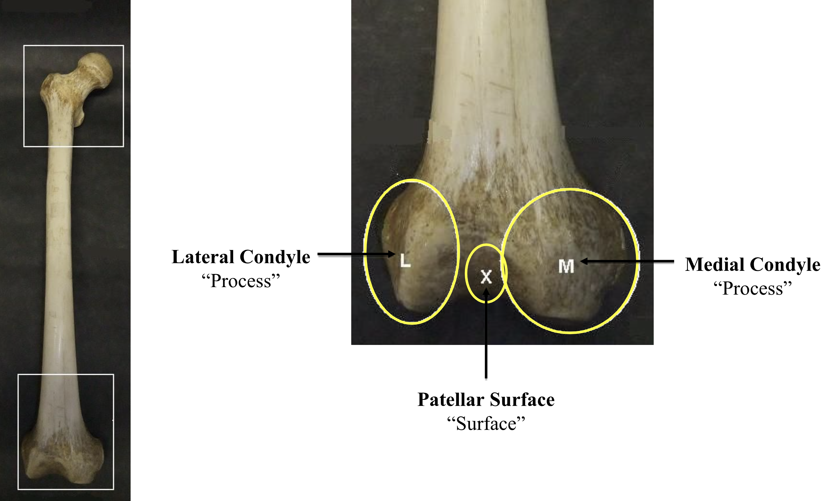 <p>Lateral Condyle, Patellar Surface, Medial Condyle </p>