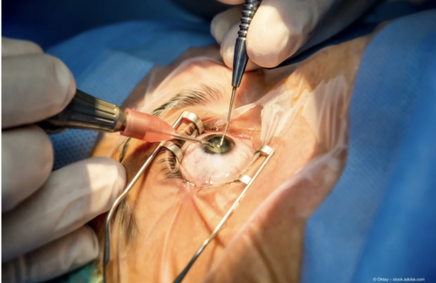 <p>Ophthalmologist</p>