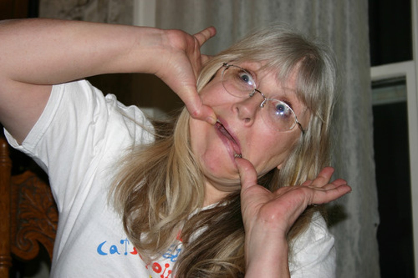 <p>ranges from unusually active to barely moving; unusual grimaces and gestures</p>