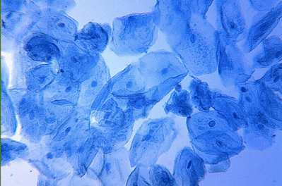 <p><span>What type of cells are shown below?</span></p>