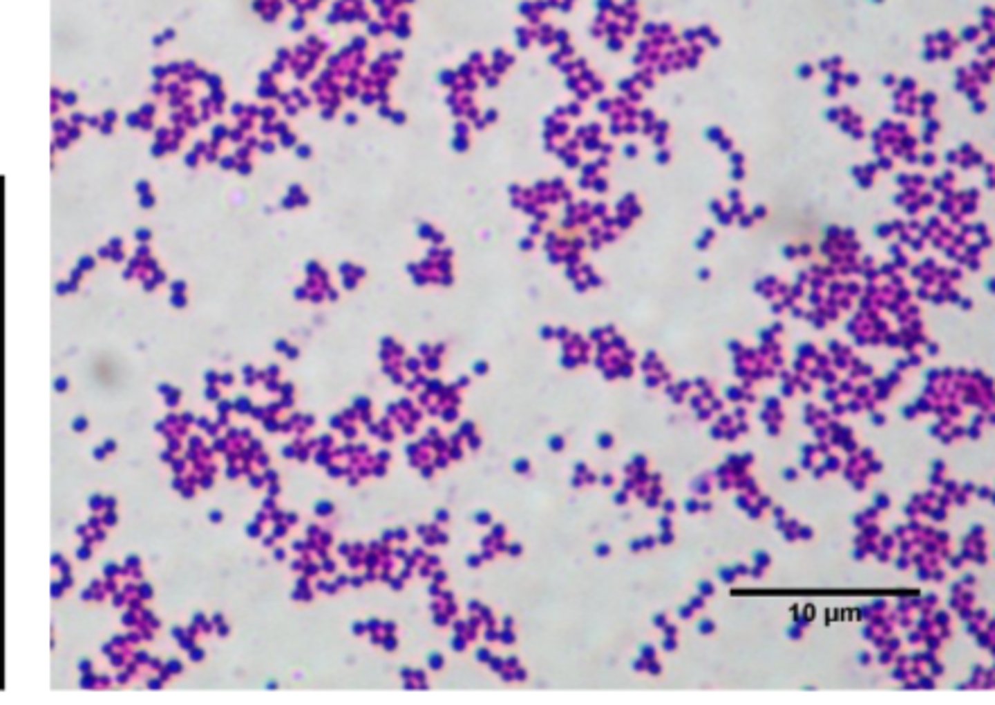 <p>• Golden pigment</p><p>• Gram positive cocci in clusters</p><p>• Beta-hemolytic </p><p>• Catalase: Positive</p><p>• Coagulase: Positive</p>