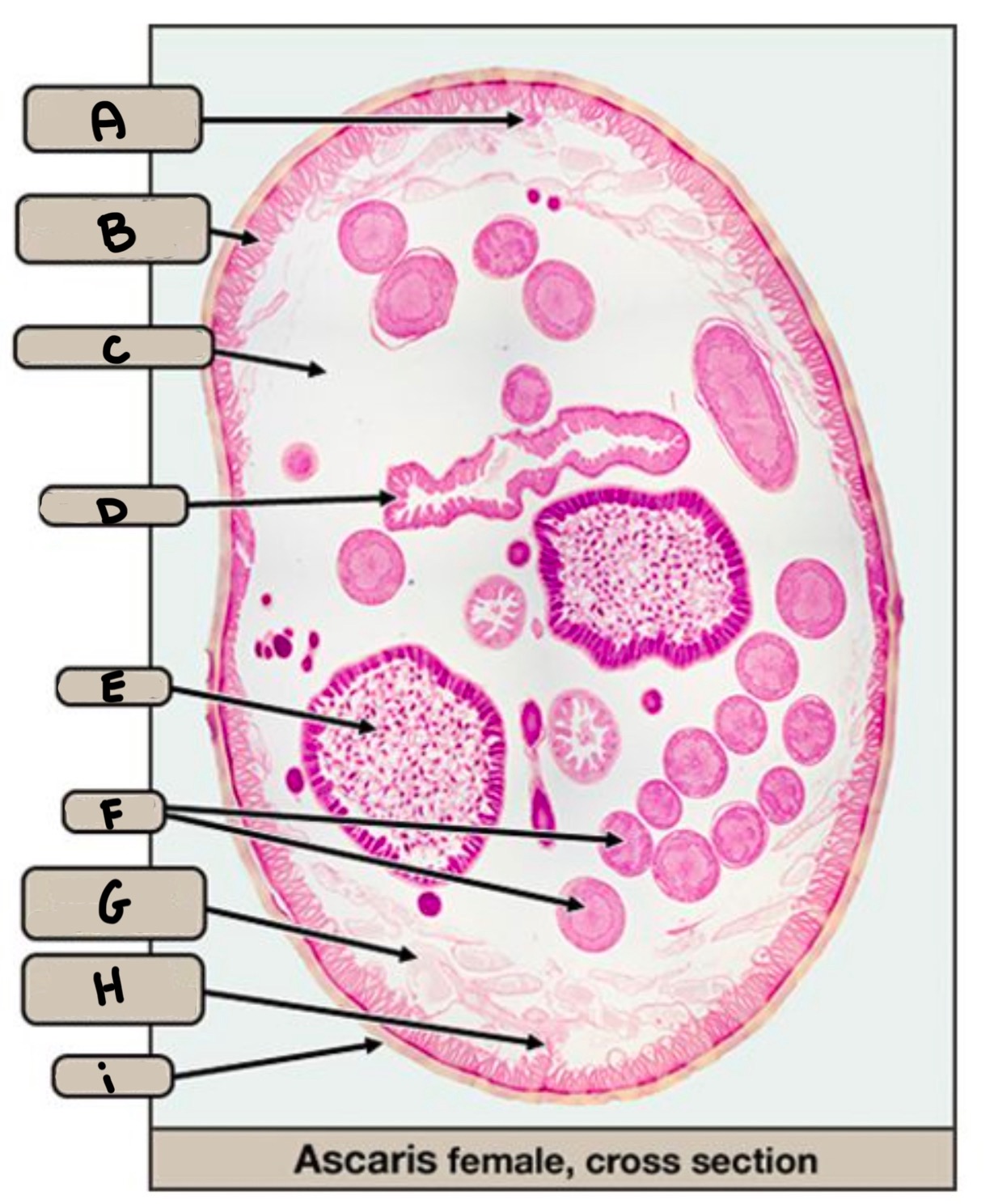 <p>What part of the ascaris is labeled E</p>