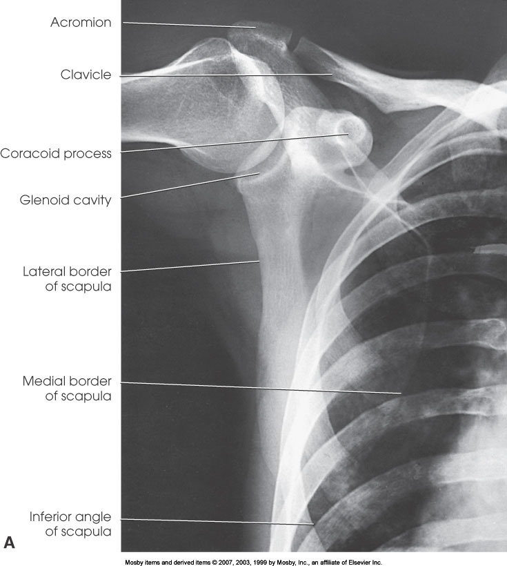 <p>What position is demonstrated?</p>