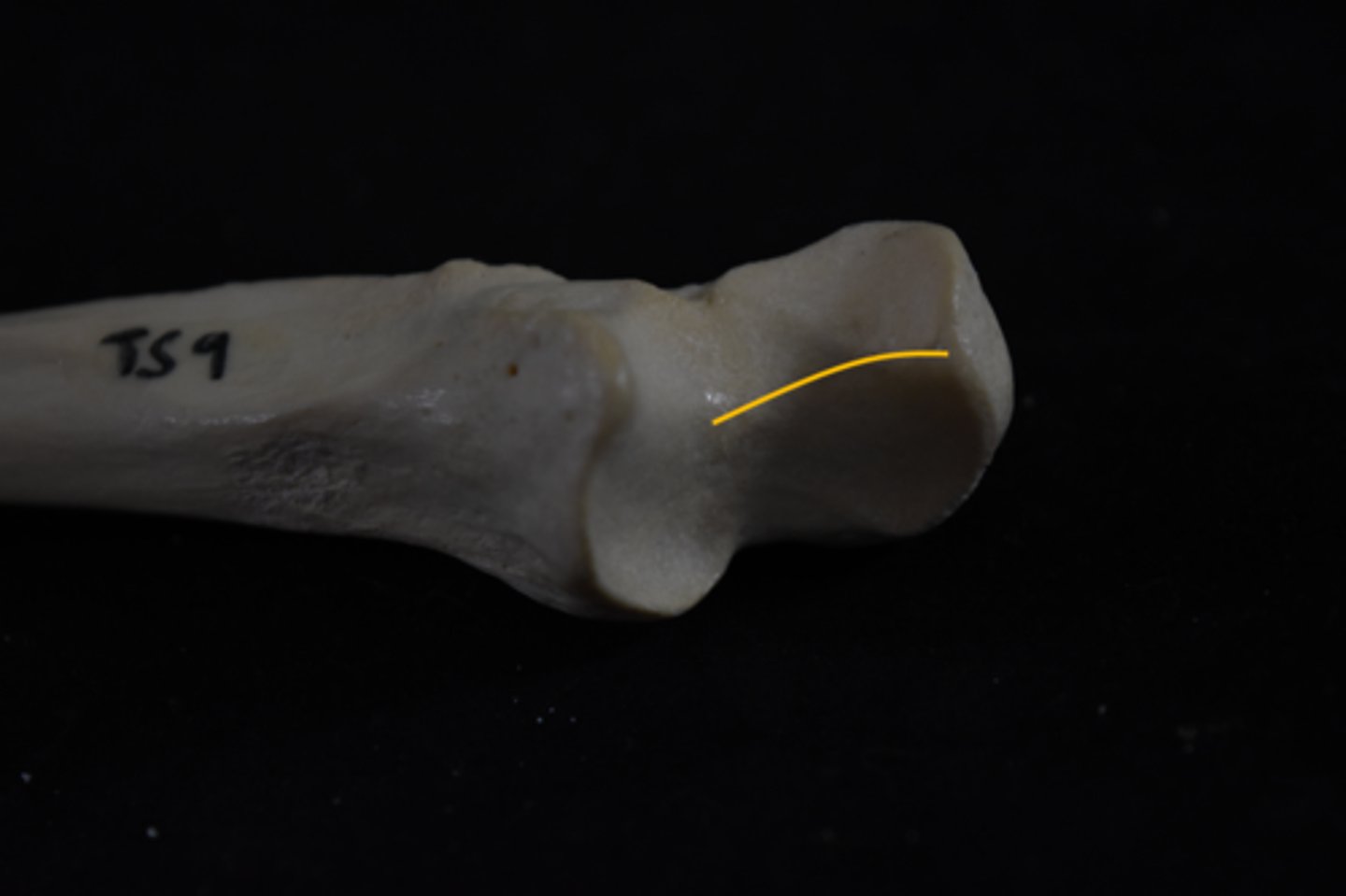 <p>convex side shows left/right ulna</p>