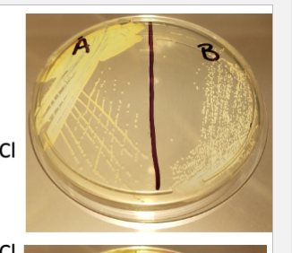 <p>Staphylococci Medium 110 (SM110)</p>