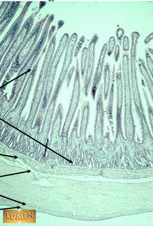 <p>this is in the</p>