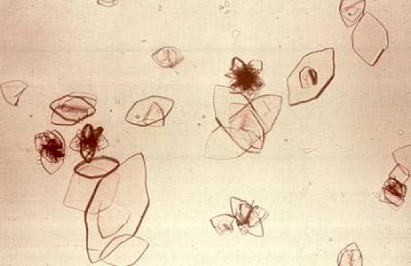 <p>rhomboid</p>