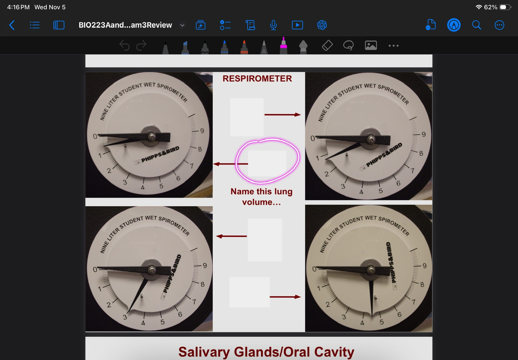 <p>Lung volume of TV</p>