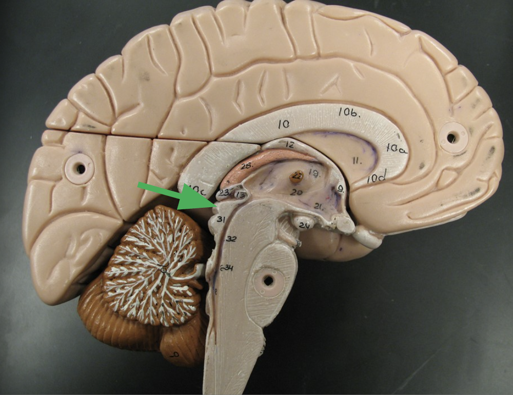 term image