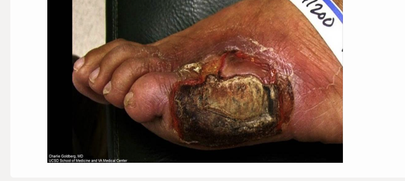 <p>the pt would benefit the most from a ____ exam</p><p>.</p><p>a) aortic duplex </p><p>b) arterial duplex </p><p>c) renal artery</p><p>d) venous duplex </p>