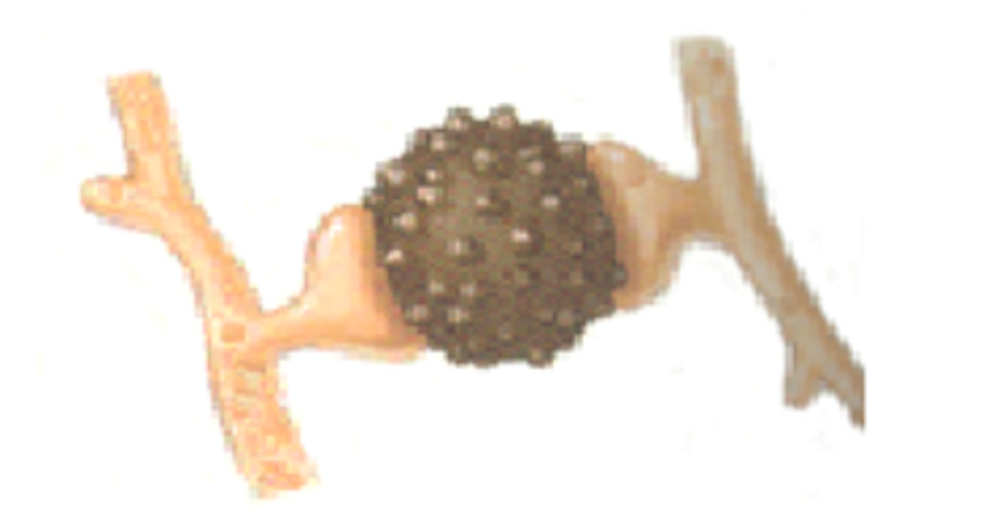 <p>Resistant zygosporangiumas sexual stage</p>