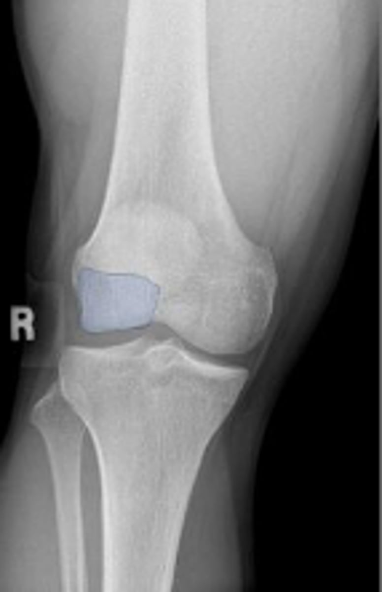 <p>What is outlined?</p>